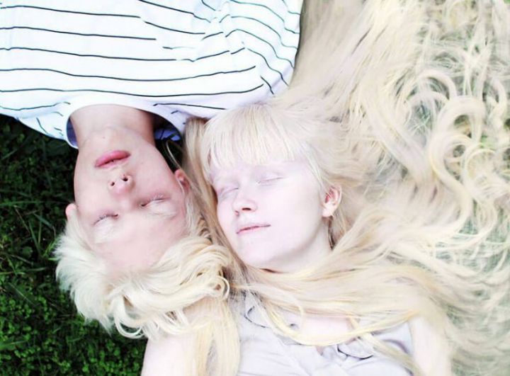 13 июня — Международный день распространения информации об альбинизме
