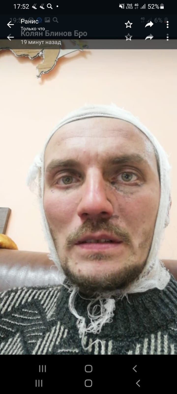 СВО: две недели продержался без воды и еды